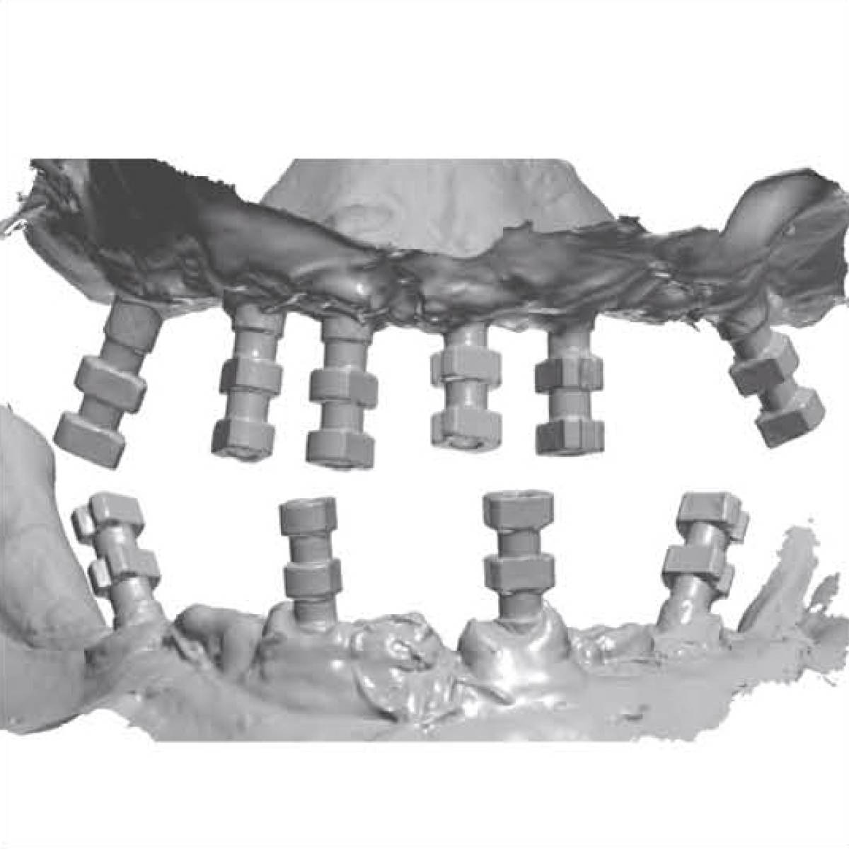 TRI Dental Implants matrix®