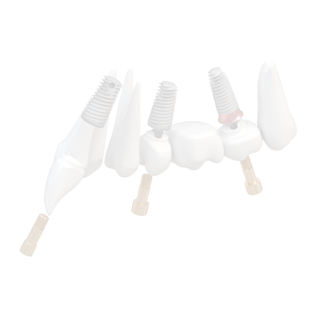 TRI Dental Implants matrix®